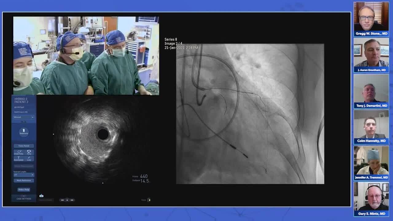 Session IV: Live Cases — LAD and RCA CTO (Emory University Medical Center)