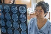 Predictors of AF May Help Guide Care After Stroke of Unknown Cause