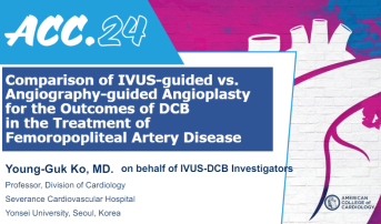 Comparison of IVUS-guided vs. Angiography-guided Angioplasty for the Outcomes of DCB in the Treatment of Femoropopliteal Artery Disease