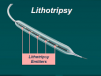 OCT-guided Treatment of Calcified Lesions